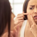 Pimples